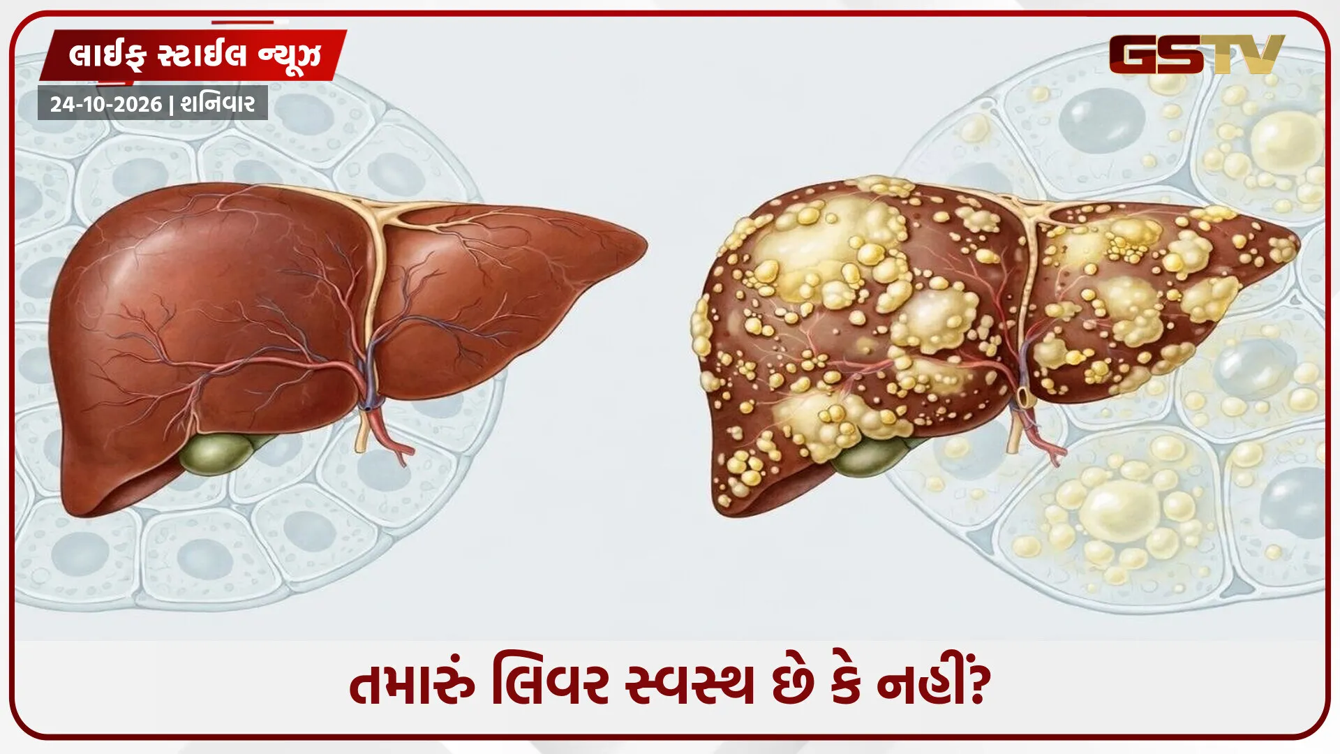 લિવર ખરાબ થવાના 5 શરૂઆતી સંકેત: સમયસર ઓળખો અને મોટા નુકસાનથી બચો!